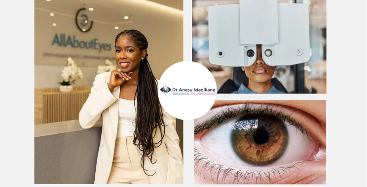 Explore LASIK Options in Cape Town with Dr Anesu Madikane